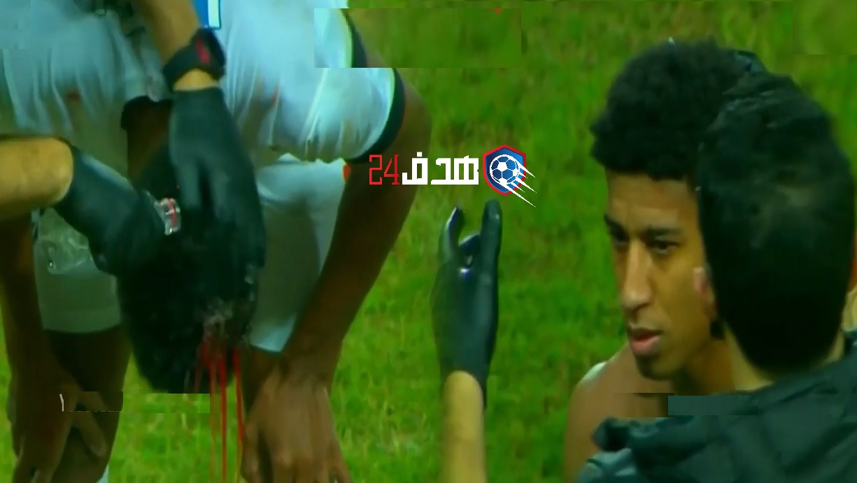 اصابة حميد أحداد الزمالك المصري zamalek Hamid Ahaddad